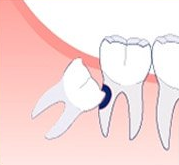 Oral Surgery