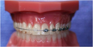 Orthodontics