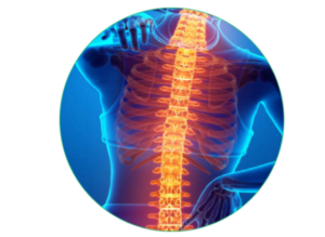 Ankylosing Spondylitis