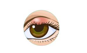 Chalazion / Eye Cyst